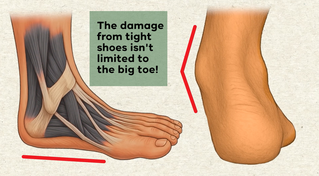 Why Narrow Toe Box Shoes Don’t Just Hurt Your Toes — They Disrupt Your Entire Body