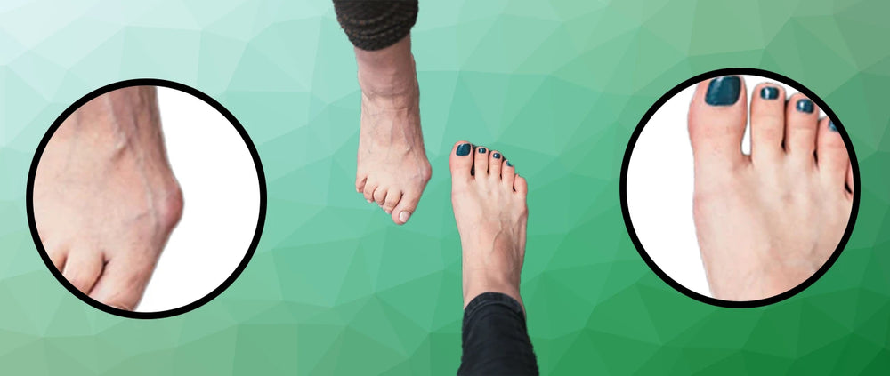 Don't do this to your toes!