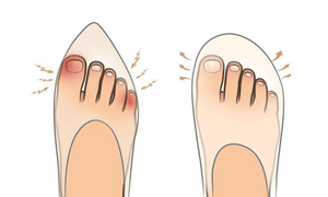Grounding Shoes Earthing Shoes Explained